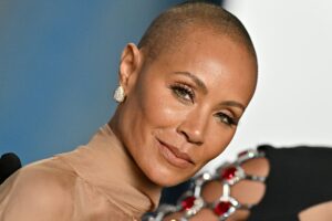 What is Alopecia? Jada Pinkett Smith’s Hair-Loss Condition is the Center of Oscar Night Controversy