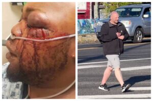 Graphic Images: Vicious Racist Attack of Portland Man Sparks Investigation