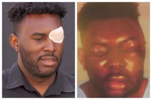 LA County Cuts a Check in Beating That Left Black Man Unrecognizable