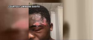 Victim of Alleged Police Brutality Incident Won’t Receive Justice, but He Won’t be Charged With Any Crimes Either